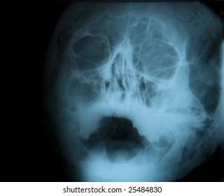 Xray Eyes Images Stock Photos Vectors Shutterstock