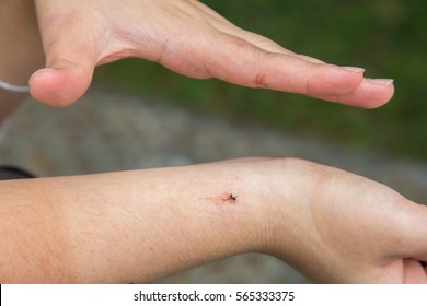 Slap Or Kill The Aedes Mosquito With Hand While Sucking Human Blood. Aedes Is Carrier Of Dengue Fever And Zika Virus.