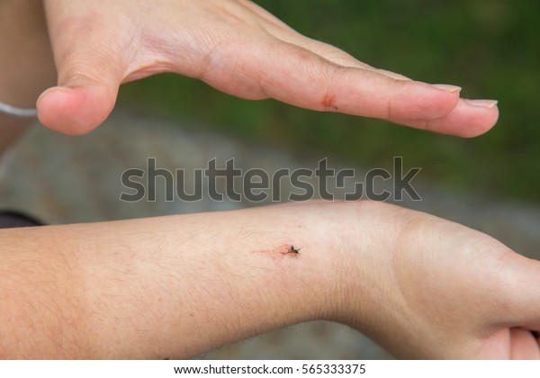 slap-kill-aedes-mosquito-hand-600w-56533