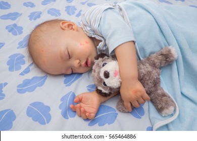 Sleeping Asian Baby With Red Spot From Mosquito Bite On A Cheek And Hand, Cute 12 Months Old Toddler Boy Taking A Nap While Holding Dog Toy On The Bed