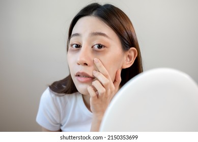 Sleepless Asian Woman Looking Her Face In The Mirror And Worry About Dark Circles Under Eyes