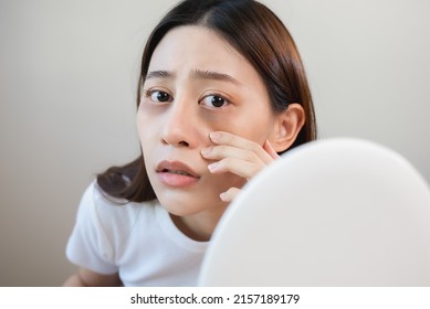 Sleepless Asian Woman Looking Her Face In The Mirror And Worry About Dark Circles Under Eyes