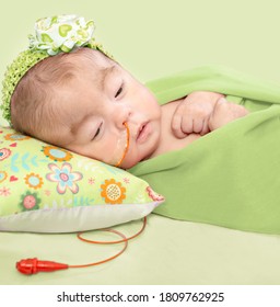 Sleepy Wrapped Baby Girl With Trisomy 18 And Nasogastric Feeding Tube