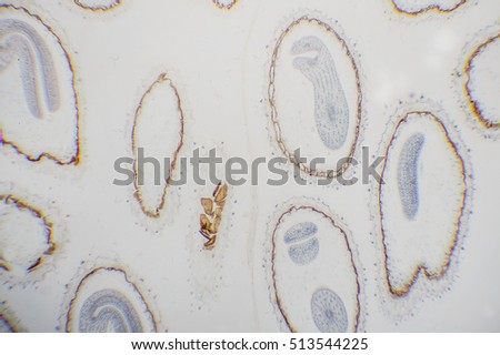 Slice capsella embryo. Microscopic- micrograph of a plant cell. Photo micro sections with high magnification with light microscope