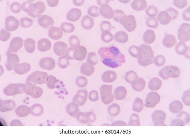 Slide Blood Smear Show Neutrophil Complete Stock Photo 630147605 ...