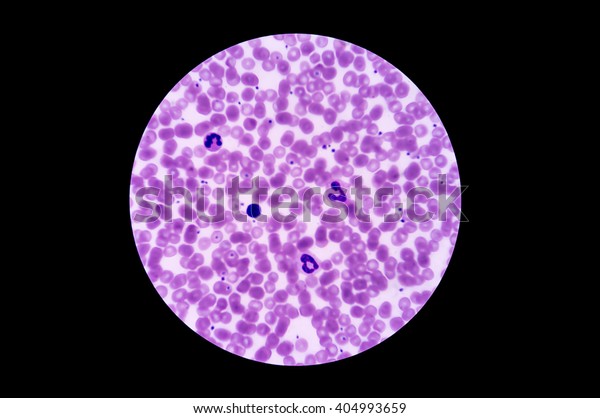 In slide blood smear show WBC, Neutroplil and\
RBC for complete blood count (CBC) test in microscope at hematology\
laboratory analysis.