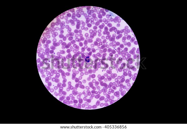 In slide blood smear show WBC, Neutroplil and
RBC for complete blood count (CBC) test in microscope at hematology
laboratory analysis.