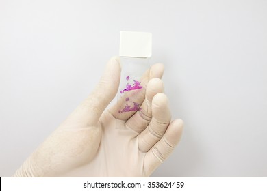 Slide Tissue Biopsy In The Hand For Diagnosis In Pathology Laboratory.