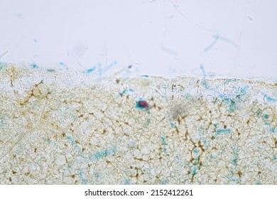 Slime Molds Group Polyphyletic Under Microscope Stock Photo 2152412261 ...