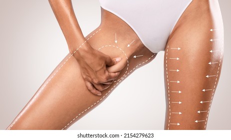 Slimming Concept. Closeup cropped view of unrecognizable young lady in white panties pinching her inner thigh with drawn arrows examining cellulite isolated on studio background. Skin Elasticity Check