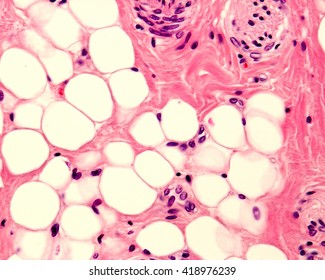 Small adipocyte lobule located in a connective tissue. A small nerve is located in the upper right corner. Light micrograph. H&E stain.