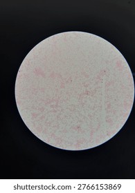 Small gram negative bacteria microscopy respiratory infection concept