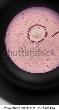 A small part of our nerve system that is really important called medulla spinalis.