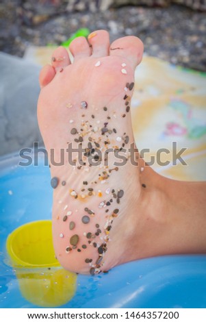 A small pebble stuck to the bottom of the feet