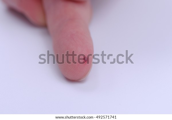 small-red-dot-on-finger-stock-photo-edit-now-492571741