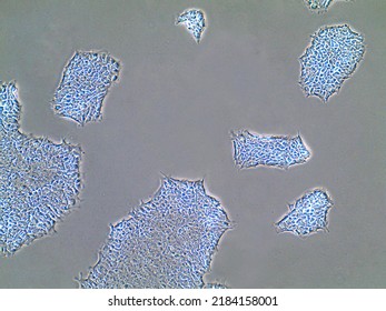 Small stem cell populations proliferating in Petri dish. Light microscopy of induced human pluripotent stem cells for regenerative medicine. - Shutterstock ID 2184158001