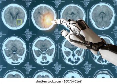 smart medical concept, artificial intelligence use for detect cancer or injury in brain it use deep learning brought what is known as Neural Networks as a way to analyze large and complex datasets. 