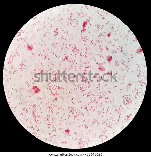 Smear Gram Negative Bacilli Bacteria Under Stock Photo 758648626 ...