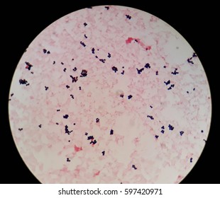 cocci bacteria under microscope