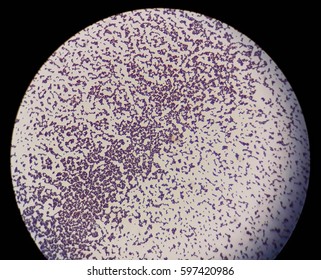 cocci bacteria under microscope