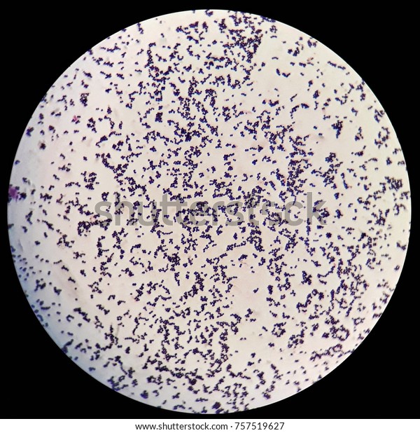 cocci bacteria under microscope