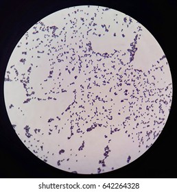 cocci bacteria under microscope