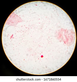 Smear Grams Stained Sputum Specimen Gram Stock Photo 1671860554 ...