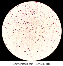 Smear Human Blood Culture Grams Stained Stock Photo 1092733418 ...