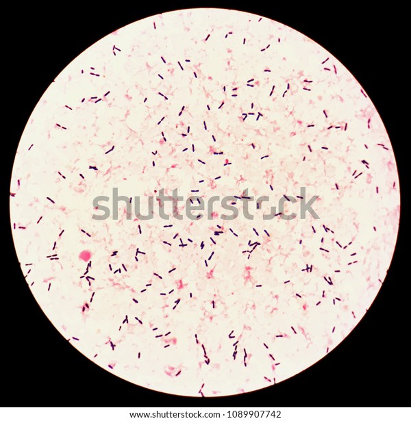 Smear Human Blood Culture Grams Stained Stock Photo 1089907742 ...