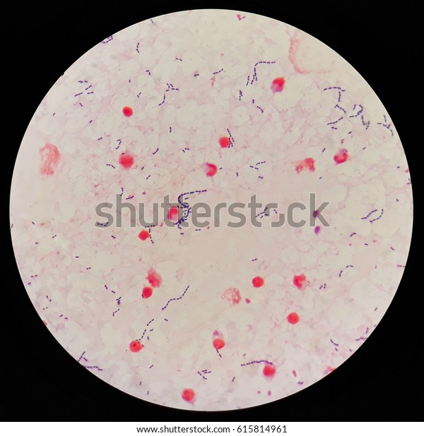 Smear Human Blood Culture Grams Stained Stock Photo (Edit Now) 615814961