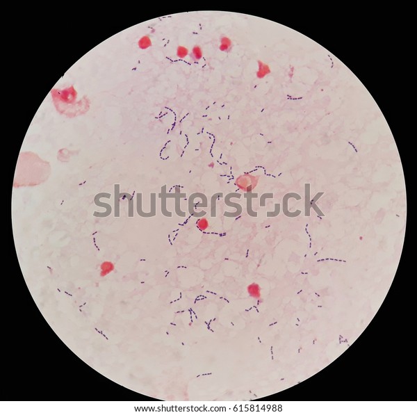 Smear Human Blood Culture Grams Stained Stock Photo (Edit Now) 615814988