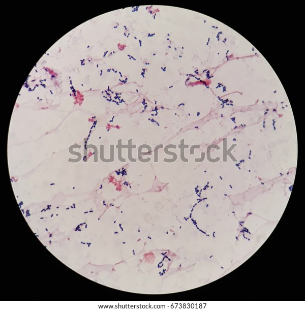 Smear Human Blood Cultured Grams Stained Stock Photo 673830187 ...