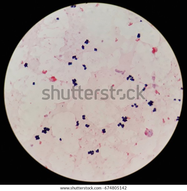 Gram Positive Cocci Blood Culture