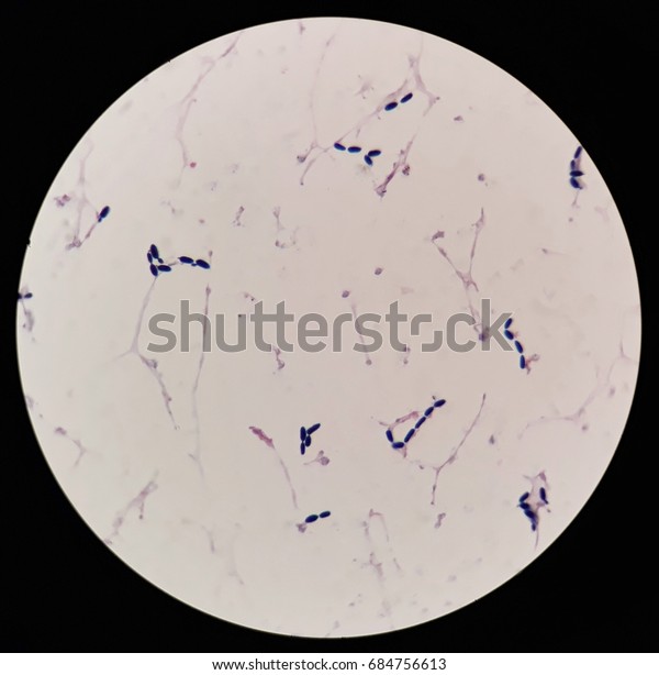 Smear Human Blood Cultured Grams Stained Stock Photo (Edit Now) 684756613