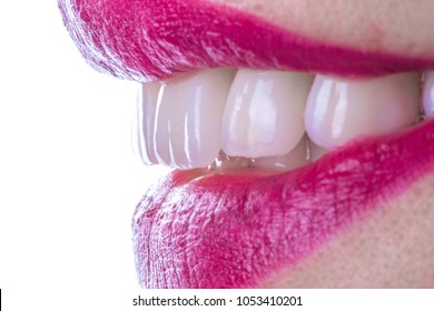 Smile Veneers Teeth