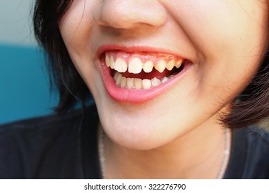 Smile of woman - Shutterstock ID 322276790