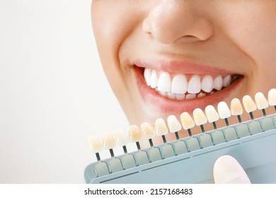 Smile of a young woman. Cosmetological teeth whitening in a dental clinic. selection of the tone of the implant tooth - Shutterstock ID 2157168483