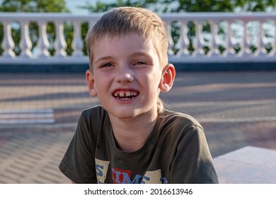 A Smiling Boy Sits On The Embankment, He Is Seven Years Old, He Has A Tooth. 