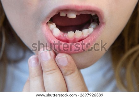Smiling child with missing teeth. Kid showing tooth gap. Closeup of baby teeth. Child losing milk teeth. Kids missing tooth. Child dental concept.