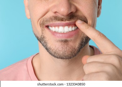 Smiling Man Showing Perfect Teeth On Color Background, Closeup