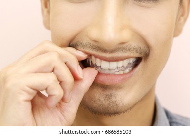 Smiling Man With Silicone Trainer Close Up For More Whitening Teeth, Holding Invisible Braces, Home Whitening Or Bleaching Gel Tray Opalescence.