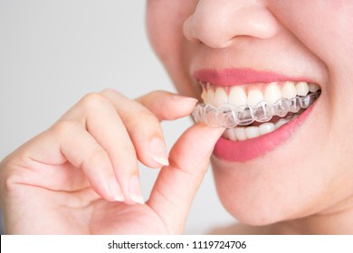 A Smiling Woman Holding Invisalign Or Invisible Braces, Orthodontic Equipment