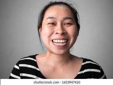 Smiling Woman's Teeth Revealing  White Spots And Plaque On The Tooth Surface With Abnormal Tooth Structure, The Lower Teeth Protrude To The Front. Oral Care And Dental Concept.