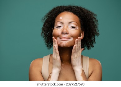 Smiling young african woman with vitiligo condition doing self massage with hands standing isolated on green background, close up - Powered by Shutterstock