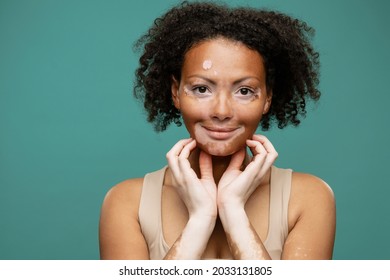 Smiling young african woman with vitiligo condition doing self massage with hands standing isolated on green background, close up - Powered by Shutterstock