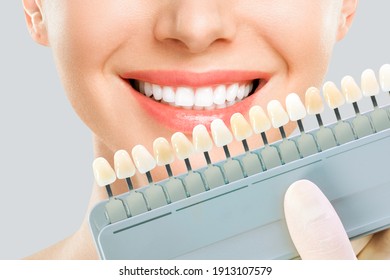 Smiling young woman. Cosmetological teeth whitening in a dental clinic. selection of the tone of the implant tooth.