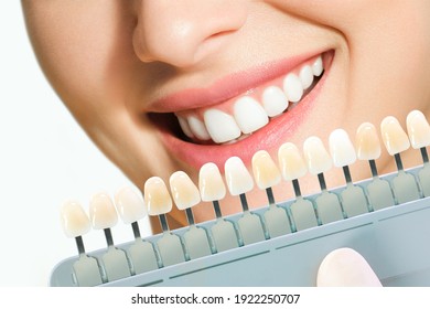 Smiling young woman. Cosmetological teeth whitening in a dental clinic. selection of the tone of the implant tooth.