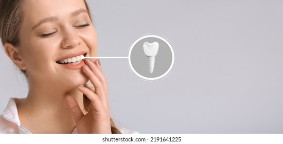Smiling young woman with implanted teeth on light background - Shutterstock ID 2191641225