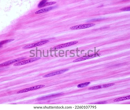 Smooth muscle fibers longitudinally sectioned. These cells show a very elongated fusiform nucleus which contains small nucleoli.