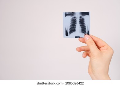 A Snapshot Of A Fluorogram Of The Lungs In Hand, Space For Text.